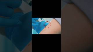 IM injection💉 intra muscular how to inject injection nursing mbbs shorts [upl. by Ysset]