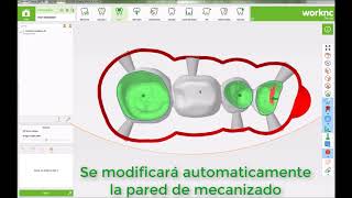 WorkNC Dental Novedades 2017 R2 [upl. by Lam]