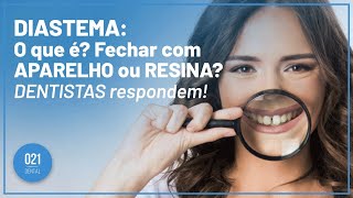 DIASTEMA O que é Fechar com APARELHO ou RESINA DENTISTAS respondem [upl. by Kele]