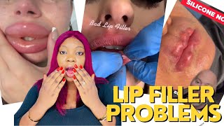 The DANGERS Of TIKTOK LIP FILLER TECHS [upl. by Hortensa]