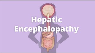 Cirrhosis – Hepatic encephalopathy [upl. by Kacerek]