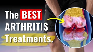 Knee Arthritis Treatments Proven to Work  The Truth You Need to Know [upl. by Aloysia236]