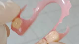 Valplast Flexible Denture [upl. by Parsaye]