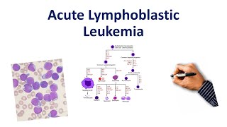 Acute Lymphoblastic Leukemia Mnemonic [upl. by Fletcher]