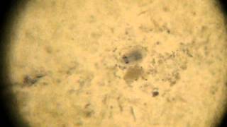 Giardia lamblia Cyst [upl. by Nohpets]