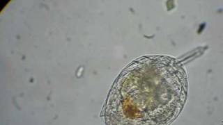 rotifer feeding on algae [upl. by Mcnamara]