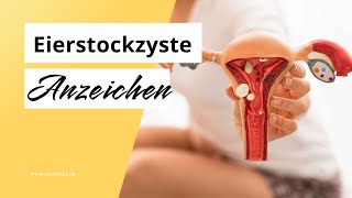 Eierstockzyste Symptome und Anzeichen [upl. by Garson]