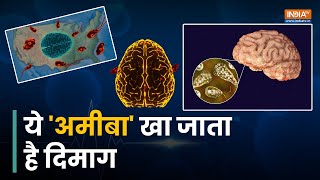 Primary amebic meningoencephalitis  तैरने गए बच्चे का दिमाग खा गया Amoeba  Brain Eating Amoeba [upl. by Aieka]