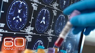 Alzheimers and Dementia  60 Minutes Full Episodes [upl. by Lodovico404]