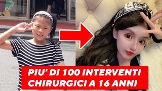 Questa Ragazza di 16 Anni ha Subito più di 100 interventi di chirurgia estetica [upl. by Ennovahc]