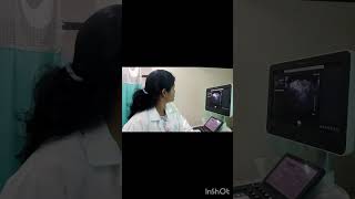 early pregnancy scan single live intrauterine pregnancy pregnancy [upl. by Eniamor]