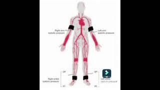 se la pressione arteriosa alle caviglie è bassa [upl. by Nosille961]