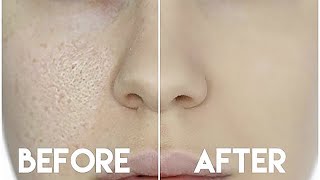 HOW TO HIDE ENLARGED PORES amp MAKE YOUR PORES DISAPPEAR [upl. by Accire]