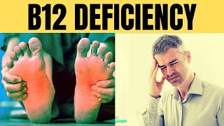 Vitamin B12 deficiency symptoms  Vitamin B12 Deficiency Of Vitamins [upl. by Hasheem]