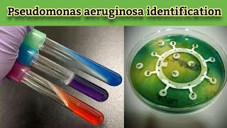 Practical work Pseudomonas aeruginosa Identification and confirmatory biochemical tests English [upl. by Rednazxela]