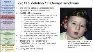 Primary immunodeficiency disorders [upl. by Servais]