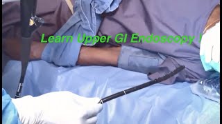 Steps of Diagnostic Upper GI Endoscopy  Dr S Easwaramoorthy [upl. by Arammat604]