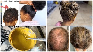 Nafaqo ama maska timaha bixya daadhsho ka ilaalinayo hair growth mask [upl. by Angelle219]