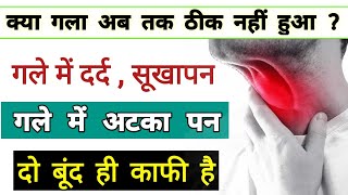 गले में दर्द  सूखापन  atkapan चुभन  lump in throat  dryness in throat  pain in throat Dr tarun [upl. by Essam]