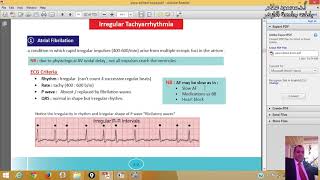 22 Arrhythmia ECG ProfDrmahmoud Allam [upl. by Francesco]