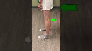 Increased Lordotic Posture Deviation [upl. by Raff317]