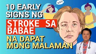 10 Early Signs ng Stroke sa Babae Na Dapat Mong Malaman  By Doc Willie Ong [upl. by Sukramal]