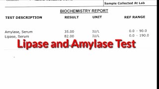 Lipase and Amylase test pancreatitis Pathology pathology bloodisorder [upl. by Dardani]