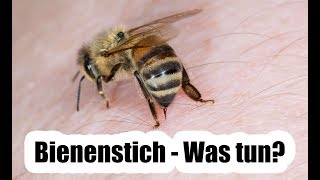 Bienenstich  Was tun Das empfiehlt der Arzt [upl. by Anelrahs229]