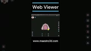 Maestro 3D  Dental Studio  WebViewer [upl. by Enailuj]