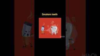 smokers teeth 🦷😁 [upl. by Attirb340]