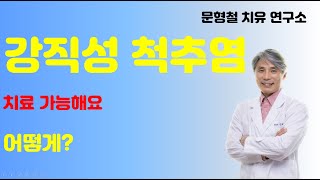 강직성 척추염  자가면역 질환이 치료가 가능하다고 어떻 [upl. by Rez503]