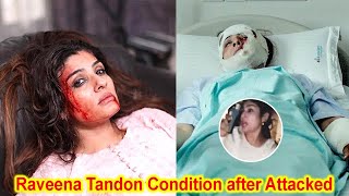 Raveena Tandon is in Critical Condition after Raveena Tandon Attacked By Mob in Mumbai [upl. by Akkeber]