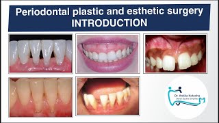 PERIODONTAL PLASTIC AND ESTHETIC SURGERYINTRODUCTIONTERMINOLOGIESOBJECTIVESDR ANKITA KOTECHA [upl. by Sig413]