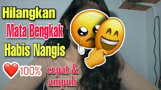 HILANGKAN MATA BENGKAK HABIS NANGIS DENGAN CEPAT [upl. by Downes]