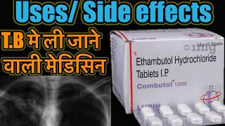 Combutol Tablet  Ethambutol Hydrochloride Tablet  TB ki Dawa  TB Medicine  Dose Side Effects [upl. by Annoyt]