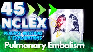 NCLEX RN 45 Pulmonary Embolism Practice Questions amp Answers  Essential Nursing Knowledge [upl. by Richardo]