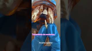 Aprende Odontología con un Modelo Dental Implantes Caries y Tratamientos Dentales… dentista [upl. by Andromada]