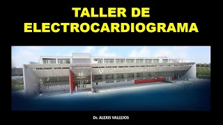 ELECTROCARDIOGRAMA I [upl. by Lilhak594]