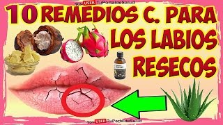 Como curar los labios resecos 10 Remedios caseros para los labios resecos o secos [upl. by Antipas]