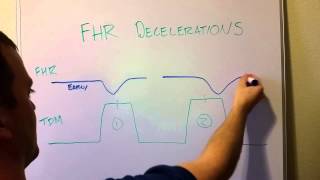 Fetal Heart Rate Decelerations Early Late Variable [upl. by Airec]