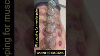 For muscles spasm chiropractor  neurotherapy  hijama [upl. by Al902]