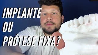 Implante ou prótese fixa  Dr Victor Hugo Almeida [upl. by Avlis755]