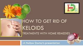 How to Get Rid of KELOIDS Treatments with Home Remedies Natural remedy for keloids Hallow doctor [upl. by Nirb419]