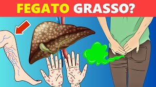 8 Segnali Che Indicano Che Il Fegato Ha Accumulato Grasso [upl. by Niwhsa]