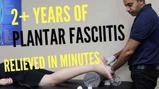 2 Years of Plantar Fasciitis Relieved In Minutes REAL TREATMENT [upl. by Giguere]