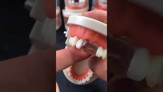 False teeth Molder Repair Gap Tooth craps🦷beadrepaircheapsavemoneyfillfixtooth [upl. by Sigismond]