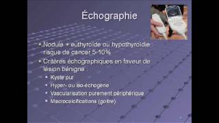 Echographie de la thyroïde  critères malins et bénins  Docteur Dana Hartl [upl. by Llien811]