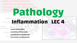 Pathology  inflammation lec 4 [upl. by Iggep]