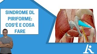 Sindrome del piriforme cosè e come si cura [upl. by Heinrik]