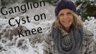 Ganglion Cyst on Knee Can Yoga Help [upl. by Dusty]